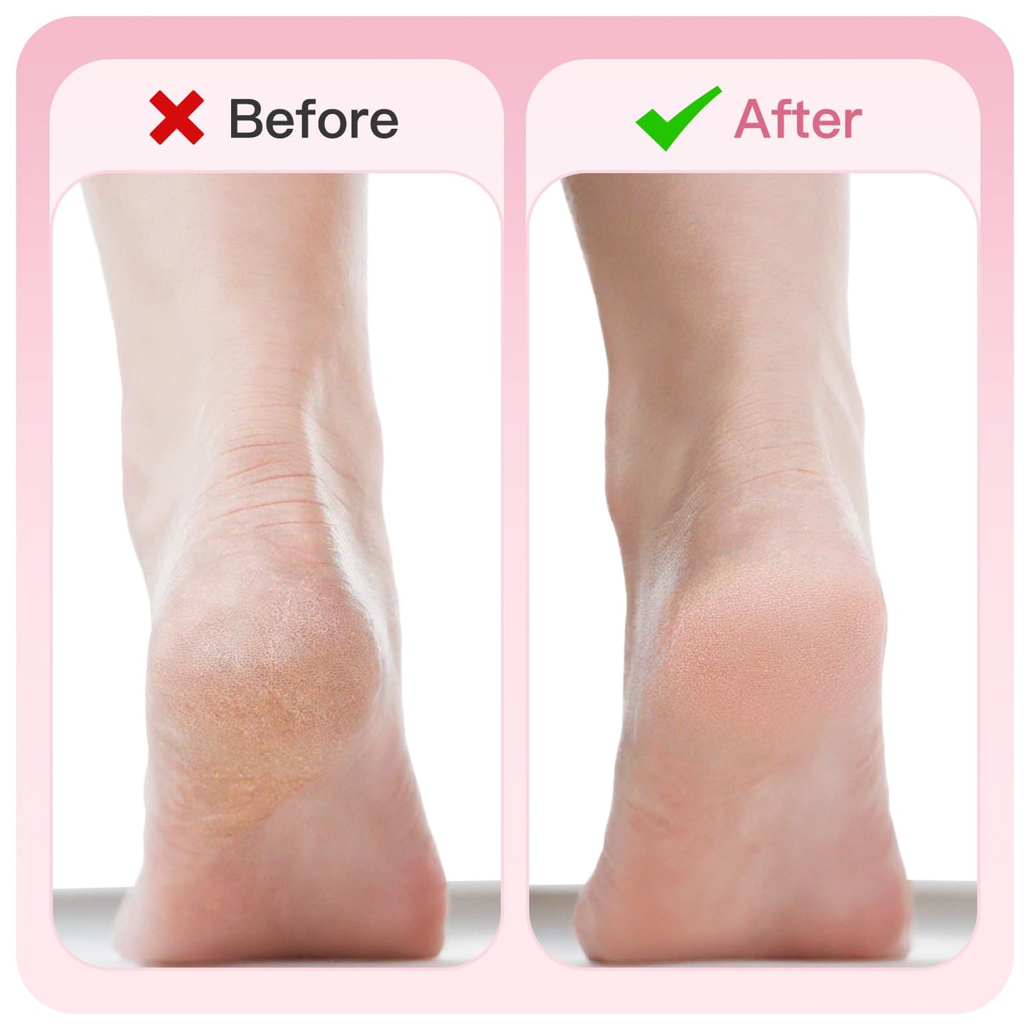 Electric Foot File Callus Remover with 60 Sandpaper Discs - Pink