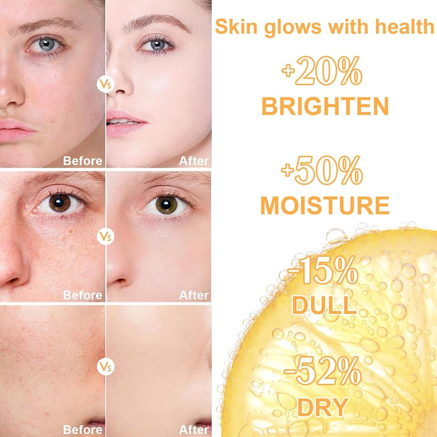 ✨ 4pc Skincare Gift Set – Vitamin C Beauty Set ✨