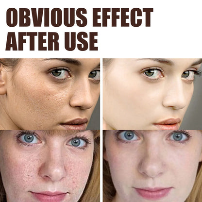 30g Retinol Cream