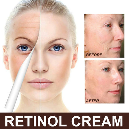 30g Retinol Cream