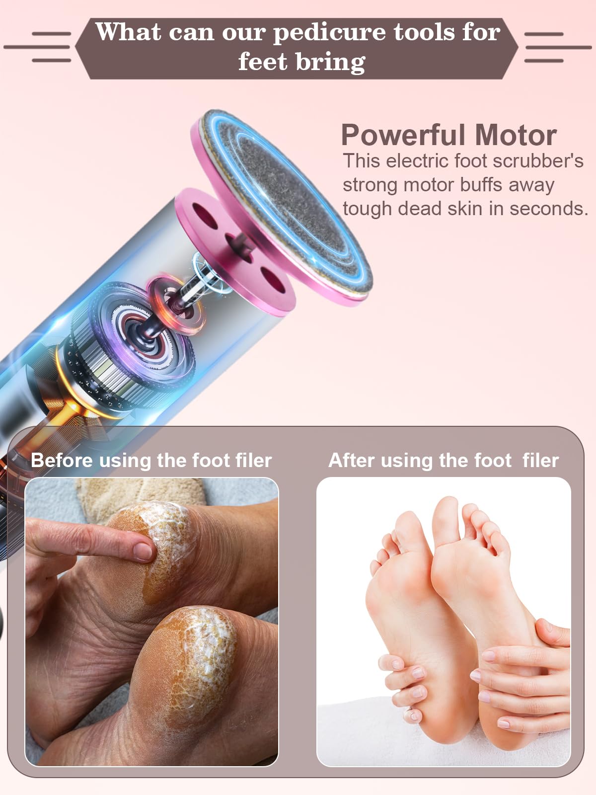 Electric Foot File Pedicure Set with 60 Grinding Discs for Cracked Heels and Callus Removal - Pink